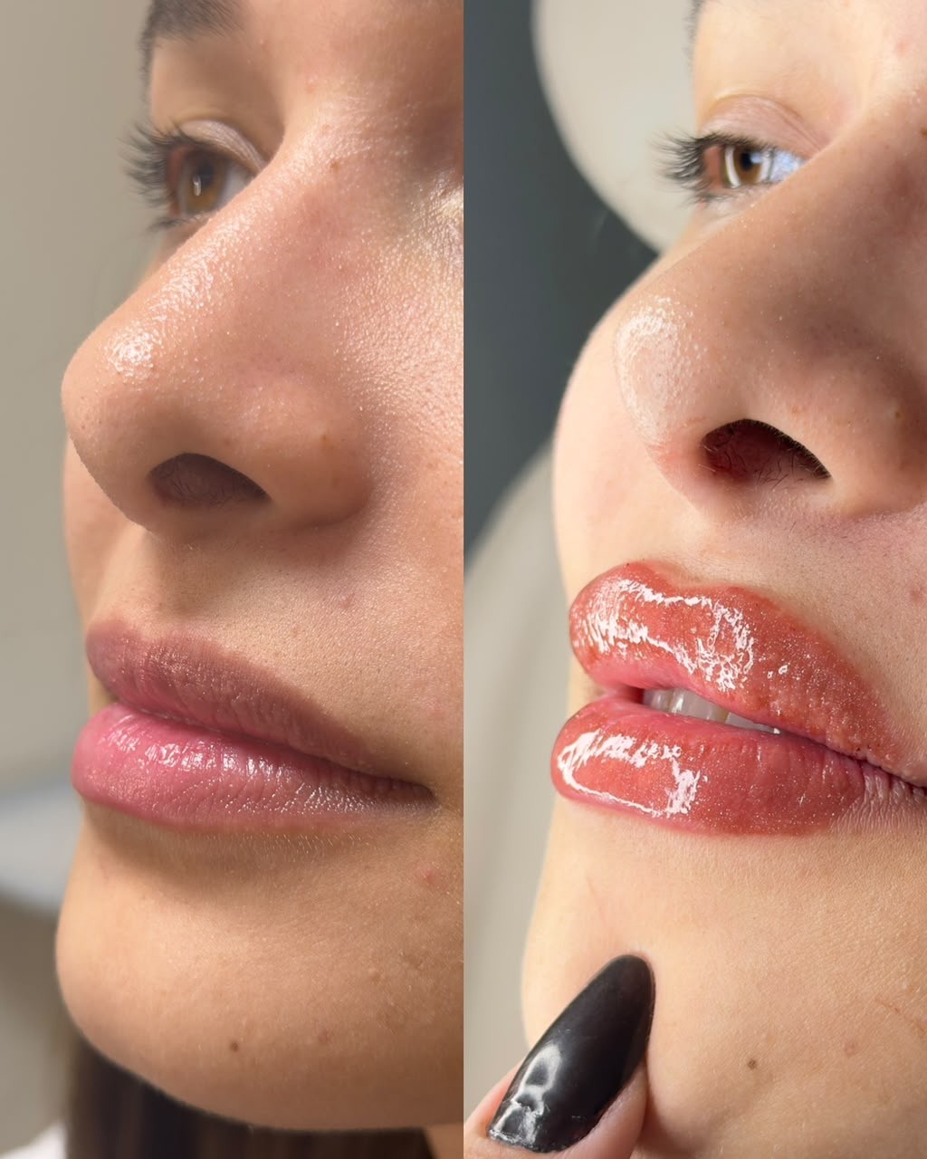 Resultado antes e depois