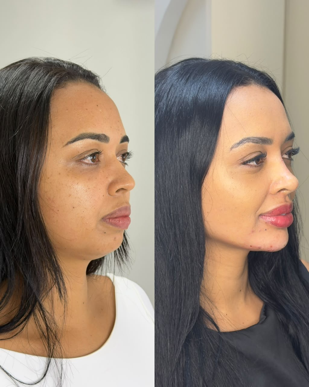 Resultado antes e depois