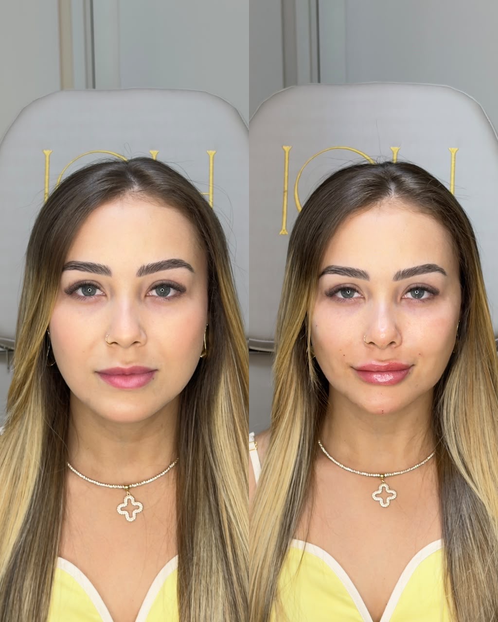 Resultado antes e depois