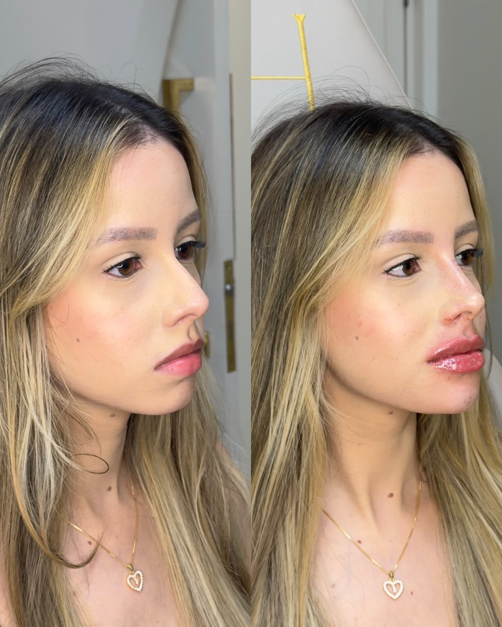 Resultado antes e depois