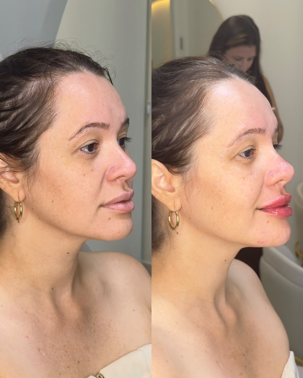 Resultado antes e depois
